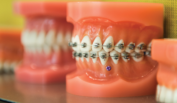 Orthodontics Welcome Image